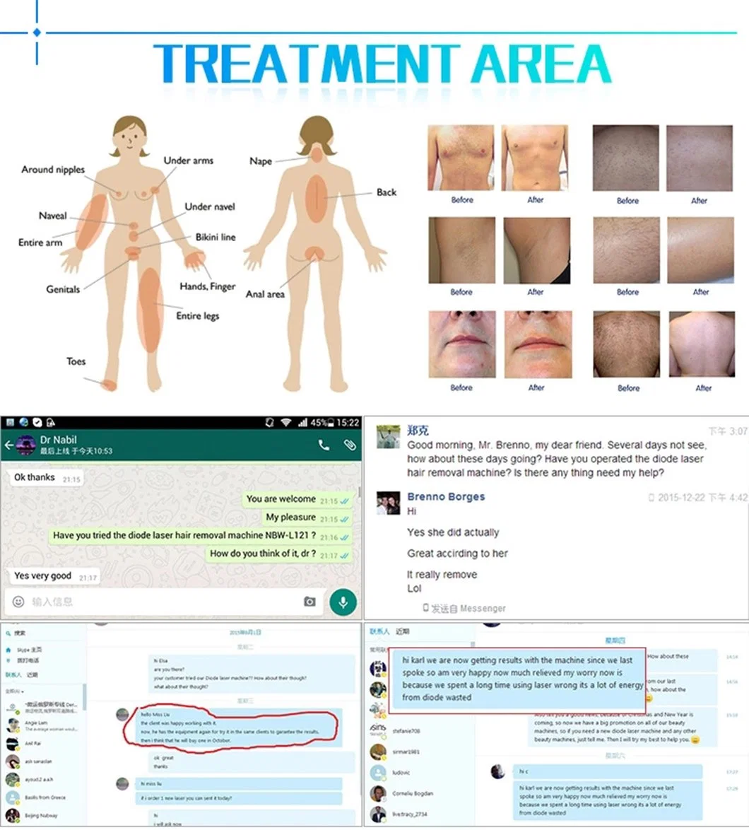 Europe Medical CE Passed Diode Ice Nya 12 Bar Permanent Hair Depilation Diode Laser Buz Laser