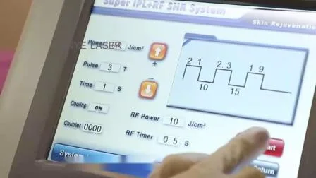 Ästhetisches Instrument Schönheitslaser IPL Entfernen Sie Gesichtsalterungsflecken YAG RF-Maschine mit Laser